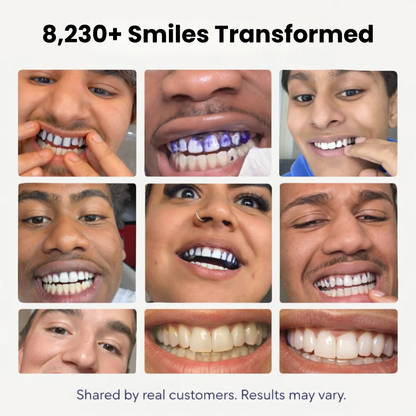 Savira InstaWhite Strips™